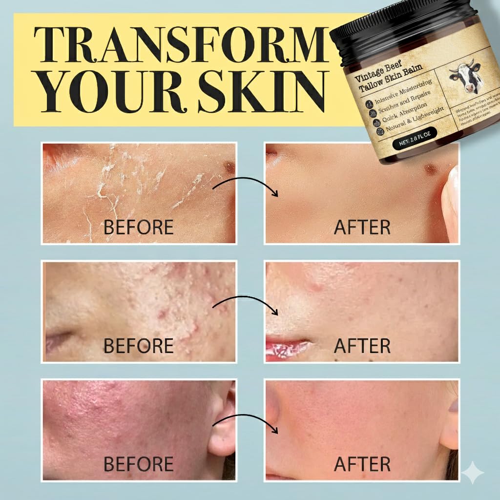 Beef Tallow Honey Balm for Sensitive Skin (honey)