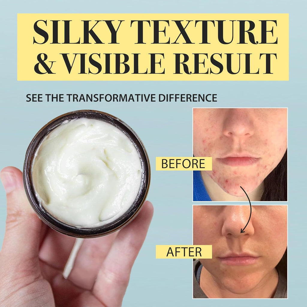 Beef Tallow Honey Balm for Sensitive Skin (honey)