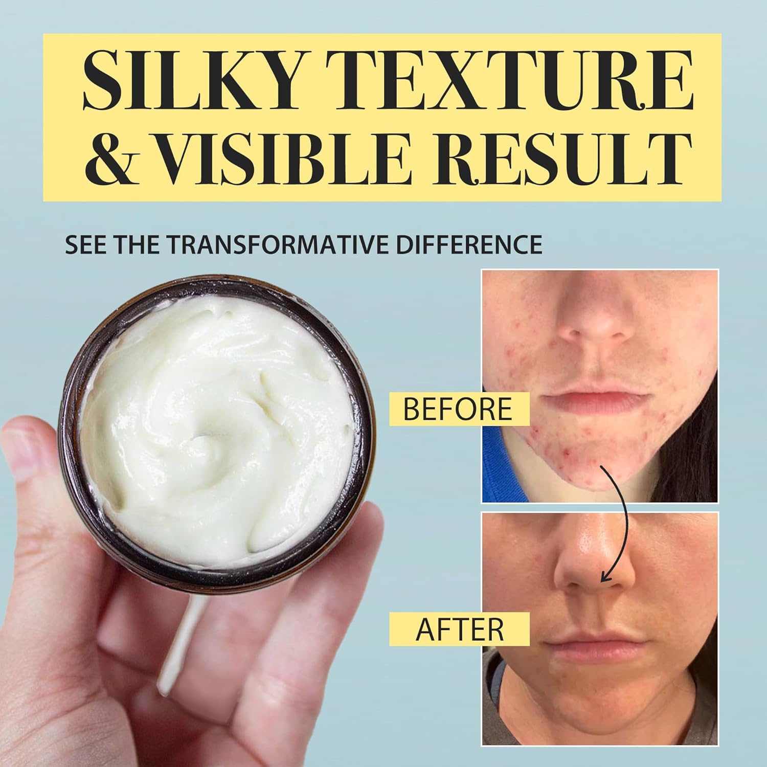 Beef Tallow Honey Balm for Sensitive Skin