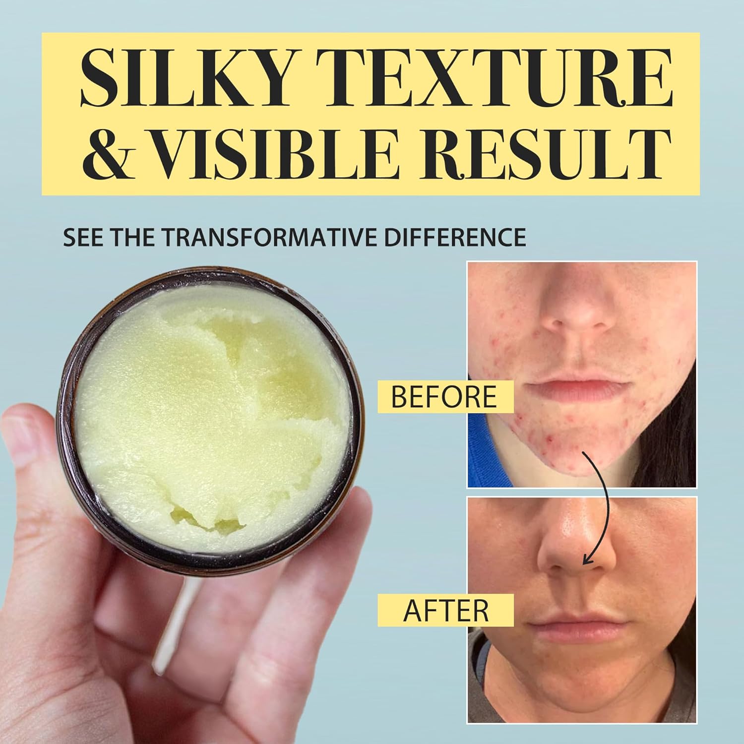 Beef Tallow Honey Balm for Sensitive Skin